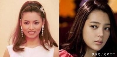 鼻子■鞠婧祎这是第几次do鼻子了?还没消肿就走红毯意外艳压全场!