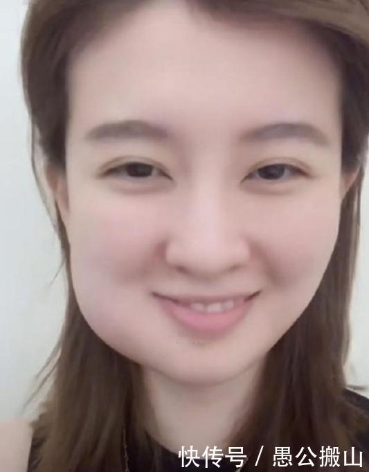 周冬雨拔智齿几颗