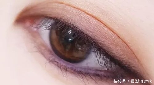  『双眼皮』韩式双眼皮手术价格贵不贵呢