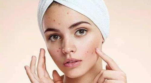 把脸上堵着毛孔的皮脂螨排出来,黑头痘痘就好了大半,不看不知道