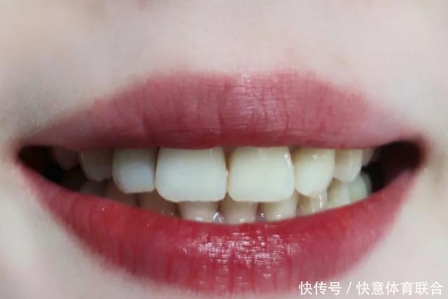 『女生』驾驭不住口红的3类女生,再贵的口红涂起来也像假货,太无奈!