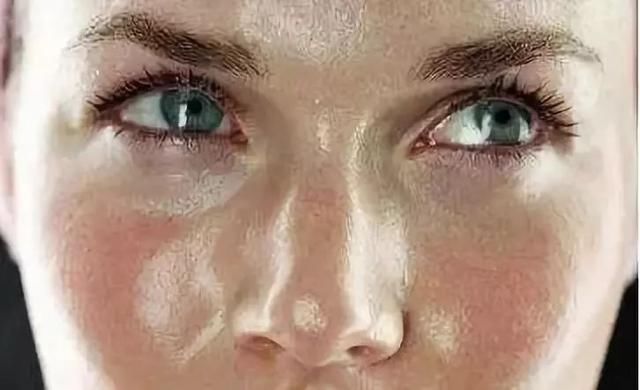 晨起脸上有这3个表现，不好意思，百万螨虫大军在脸上“做窝”了