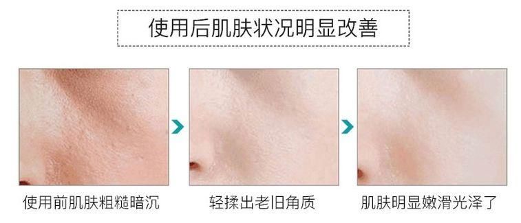 整容遭报应?她的少女脸这么快就烂了?