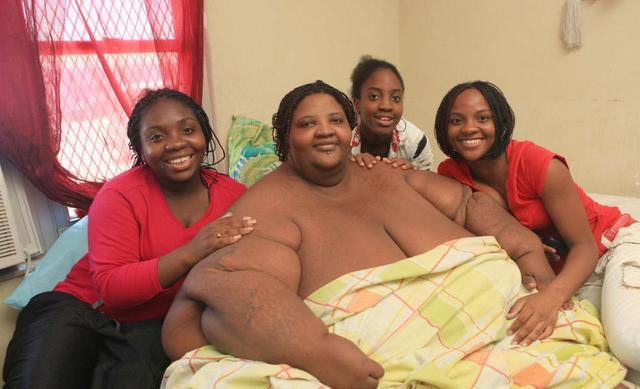 女子重300公斤，胖到没衣服穿，10年未出过门