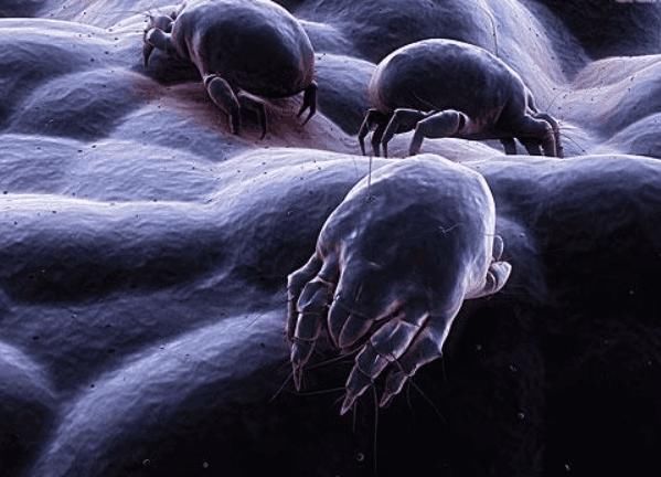 脸上出现这3个信号，暗示螨虫出击了，1种盐堪称螨虫“吸尘器”