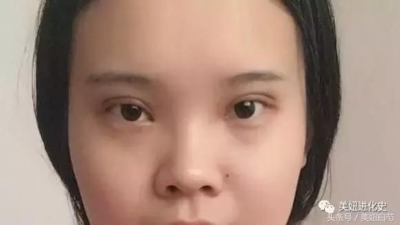 为什么她做了双眼皮却没有变美？