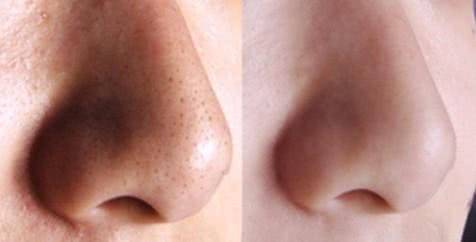 卸妆之后你有这几个现象吗？全都占了你化妆堪称整容！这四个是可