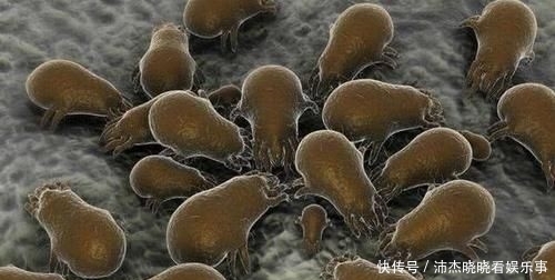 『油脂』毛孔粗大是因为螨虫挤大,三方法有效除螨, 排空毛孔螨虫