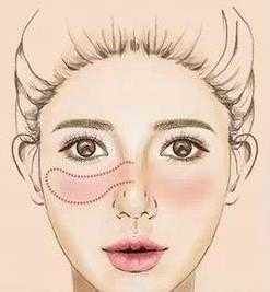 『适合』腮红怎么打:简单6款腮红画法看看哪款适合你