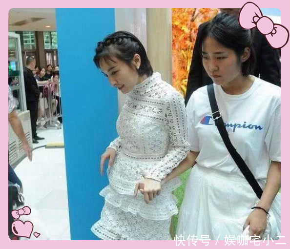 吴昕驼背穿性感短裙, 穿出来孕妇的感觉, 网友: 没有女神的仪态