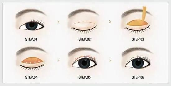  #小编建议#单眼皮与双眼皮的江湖，为什么双眼皮总能获得青睐？