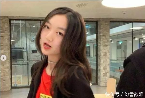 【娱乐圈里】王菲13岁女儿和冯小刚29岁女儿,同患兔唇,差距就像天壤之别