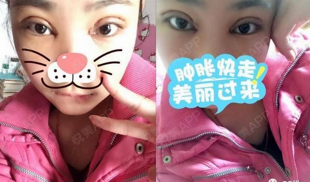  『眼睛』什么样的眼，能成就一张高级脸？|案例