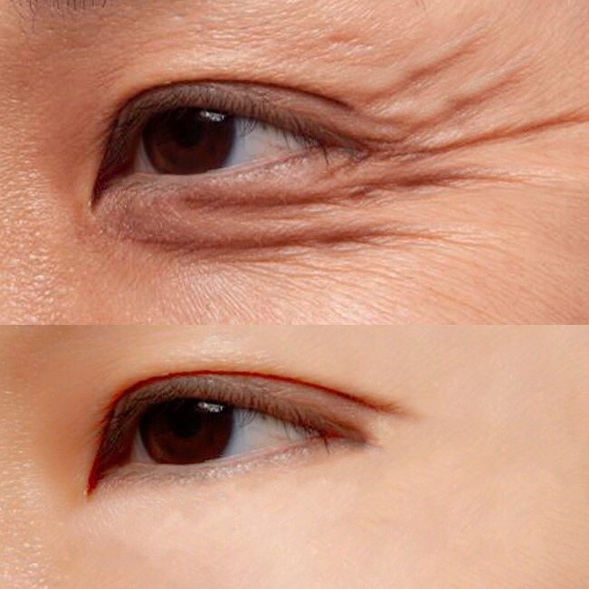 全球公认最好用的祛斑霜，祛斑效果翻千倍，可惜知道的人不多