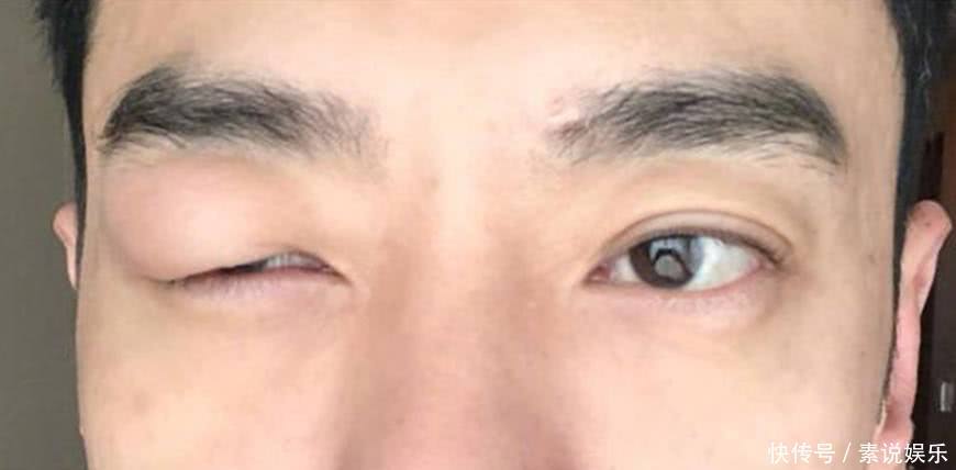 李光洁受“工伤”致全剧组停工，原因很“感人”，网友：已笑喷！