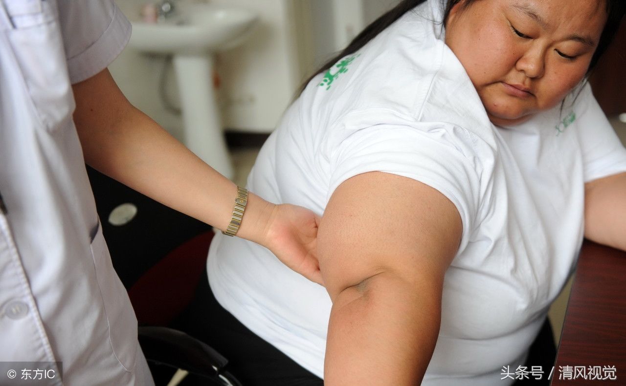 32岁姑娘体重356斤,会2门外语就业受歧视,按摩减肥欲找男友