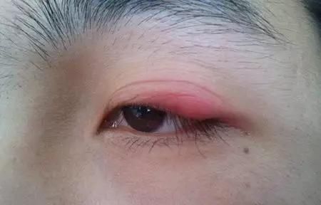 【眼睛有神】梵娅半永久:她画了三年眼线,眼睛老了十岁