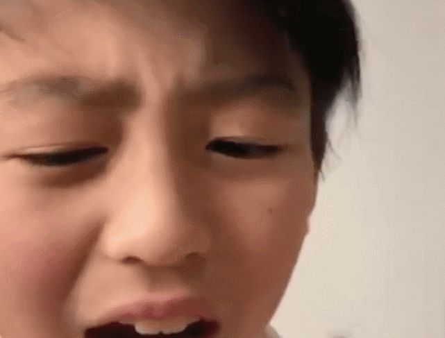 张柏芝给拔牙视频