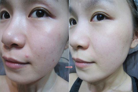 79岁的外婆告诉我:药店一不起眼药膏，擦一擦，皱纹眼袋都不见