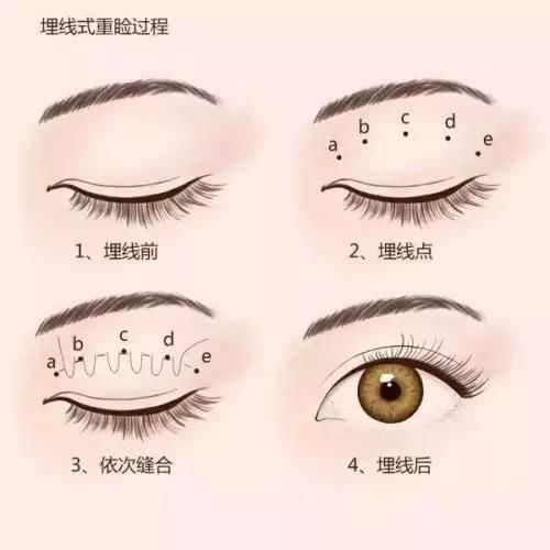 长那么好看？绝对整容了！双眼皮那么宽？是割的吧！