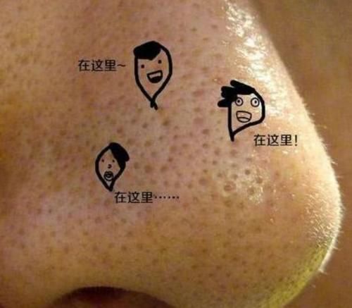  『油脂』鼻子上挤出“白色条状物”？学会这3招，趁早和“草莓鼻”说拜拜