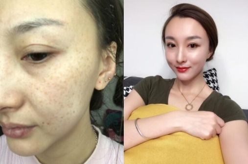 56岁像26岁?家家都有的“它”，每天晚上抹一抹，祛斑美白又祛皱