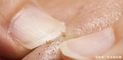 皮肤:香皂洗脸和洗面奶洗脸, 2个月后, 结局大不同!,体验: