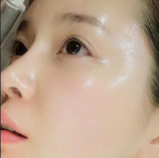 女人一定要注意:眼角长脂肪粒别挤，1个绝招轻松解决，大多不知