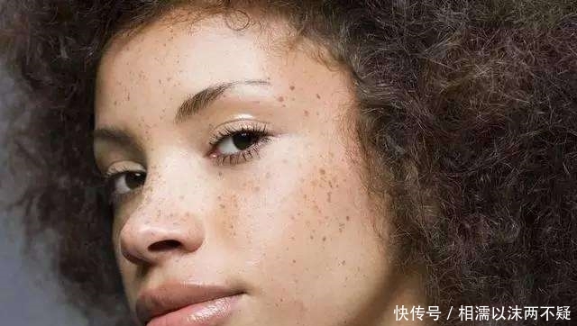 「见效快」牛奶加“它”敷脸,使用15天淡化色斑又美白,见效快还不花钱