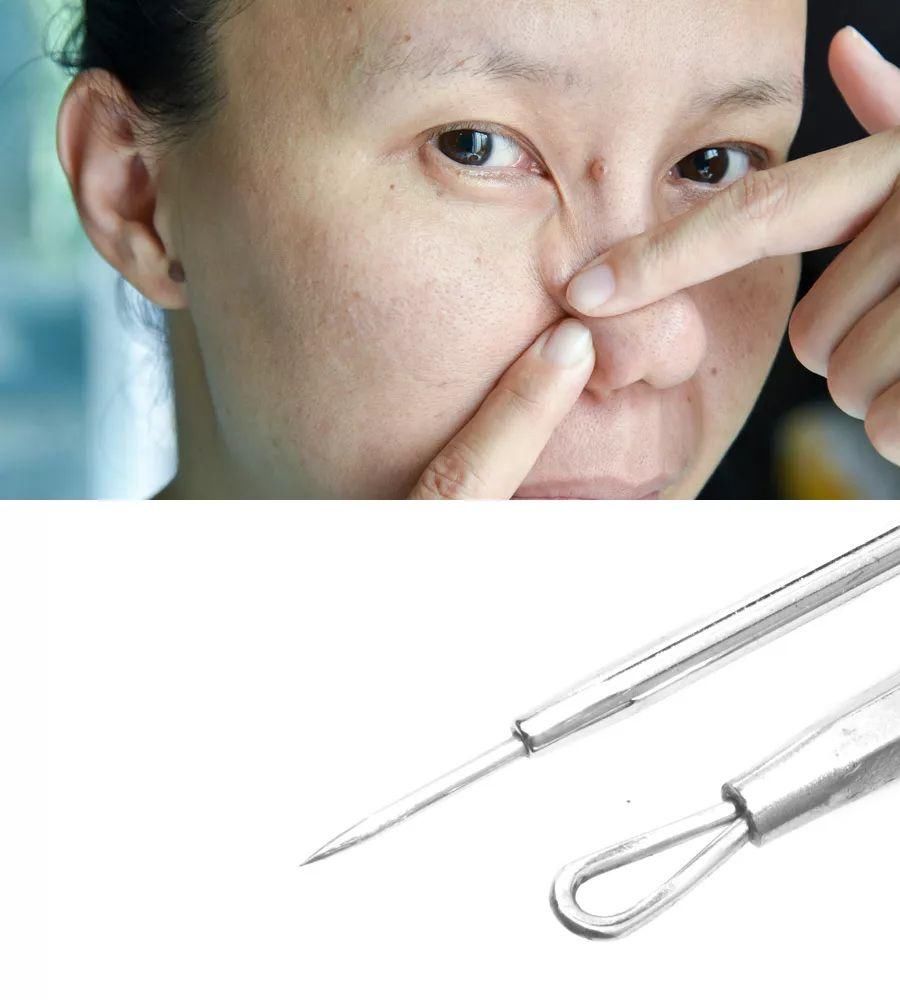 顽固黑头，一招去除，嫩白效果比美颜相机还好!