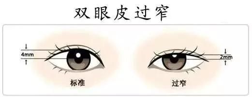  济南@想做双眼皮？先了解这8大误区！济南艺星第五季美杜莎女郎征集中