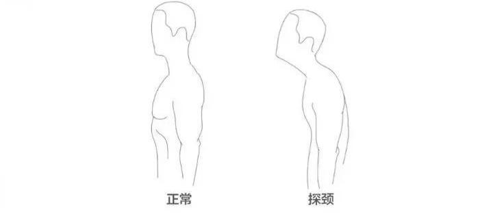 王菲和袁泉气质出众的秘诀：花几十万整容不如先解决这些？！