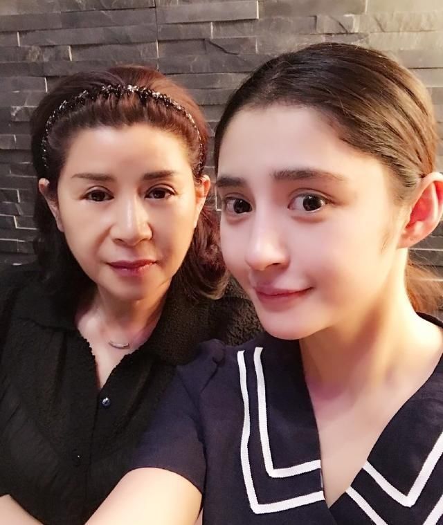 为了证明自己没有整容，有人开直播解释，有人晒出了亲妈的照片！