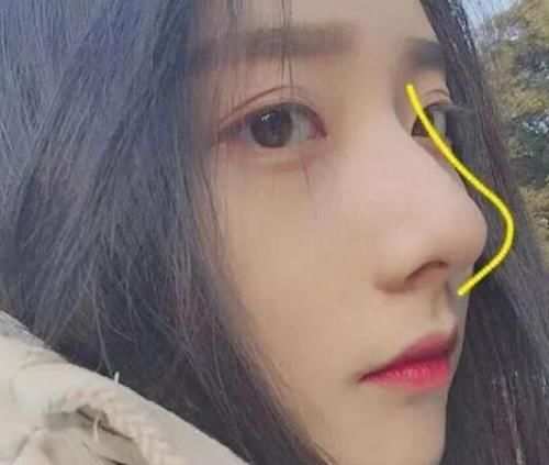 「苹果肌」女生脸部这3地方“凸起”,是标准“桃花脸”,难怪颜值“爆表”