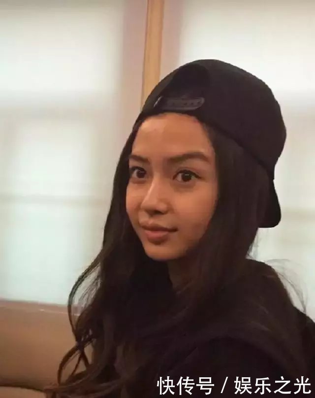 杨颖整容鉴定另有玄机? 医生公开现身辟谣, 网友: 整得好失败!