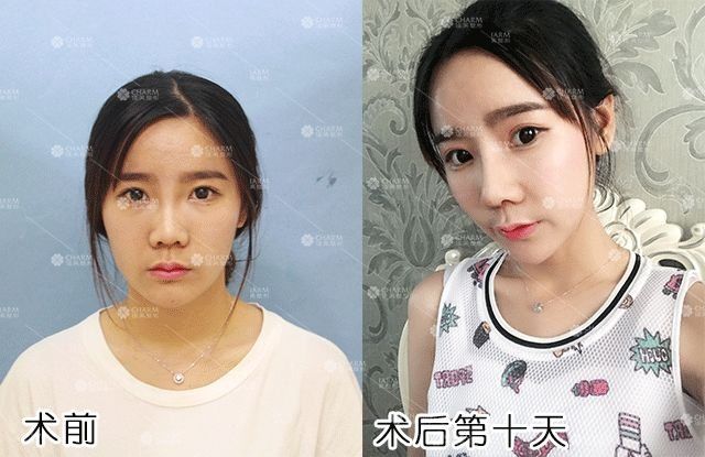 变美是一种什么样的体验?看完扎心了