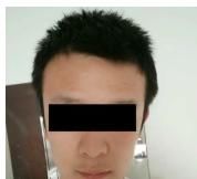 「头部两侧」男生头发两边炸毛该如何打理?