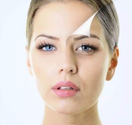 特别安全的祛斑方法，只需要一个土豆，让肌肤现出美丽原型