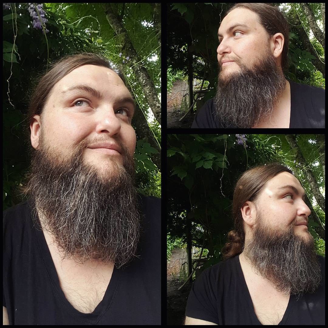 蓄起胡子留起了体毛，身患怪病的她让自己变得更有魅力了