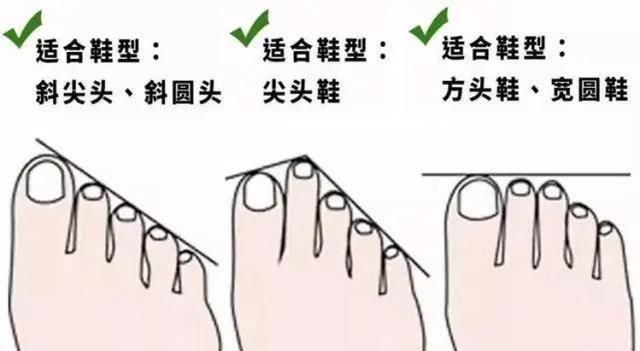  『时髦』时髦精华丽上线，难穿的细高跟鞋如何美丽出街