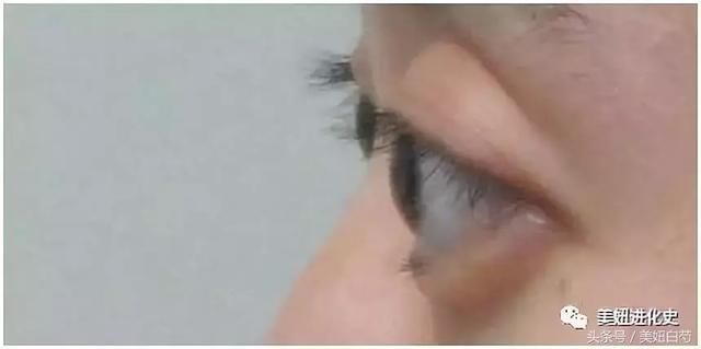 为什么她做了双眼皮却没有变美？