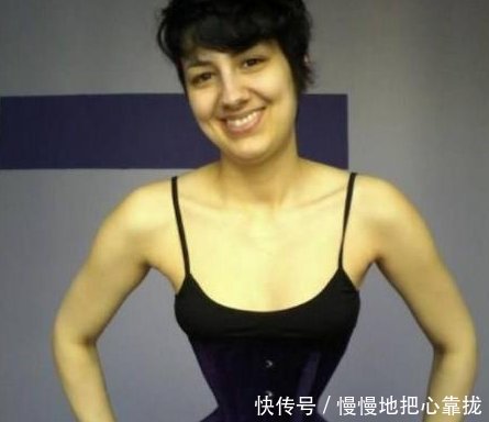 女子穿塑身衣三年未脱,她的腰最终变成了这样,看了让人瞠目结舌