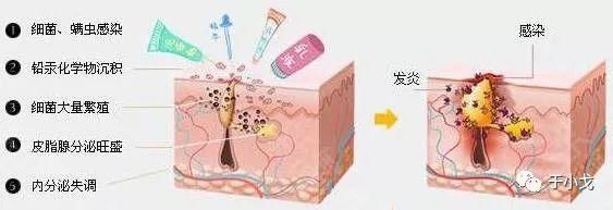 什么切乳房,烤肉,脂肪瘤,女明星写才是谣言重地