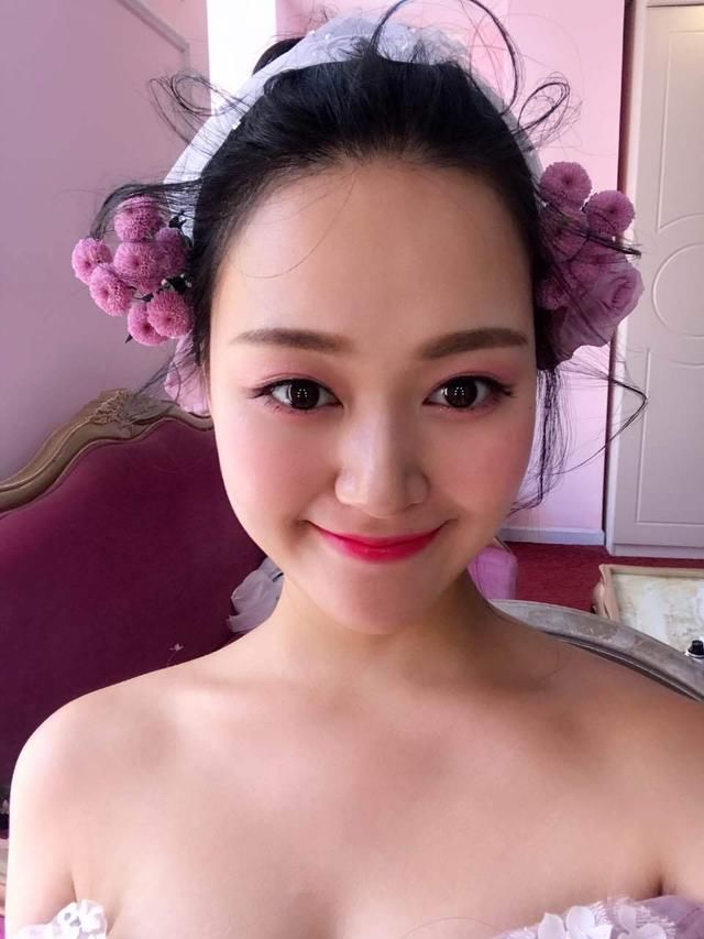 韩式双眼皮+开眼角能做出“桃花眼”吗？这篇真人案例值得参考！