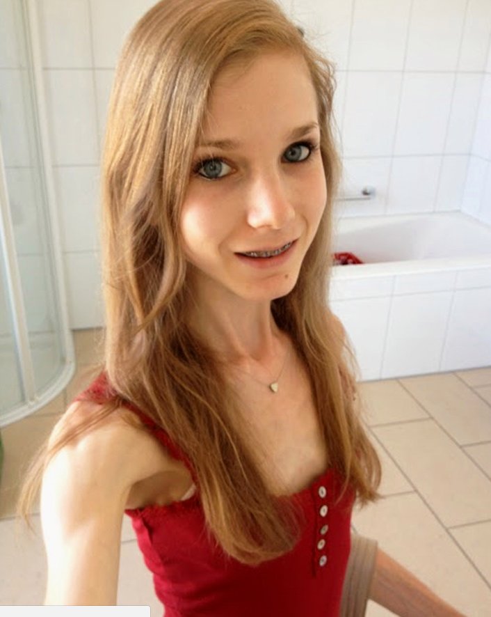 她绝食到21公斤奄奄一息,终成“微胖女神”