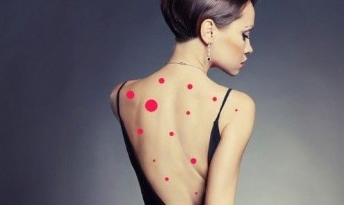 后背喜欢长痘痘？可能毛孔被上亿只螨虫掏空！用这几种方法祛痘快