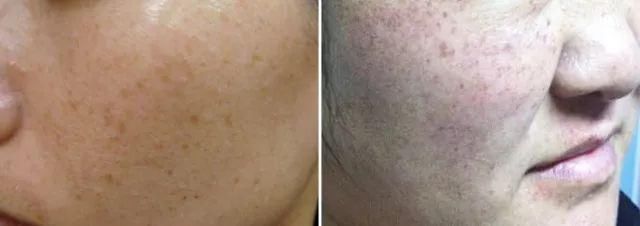 古力娜扎带火的娜丽丝要停产了?这款防晒喷雾明明更好用!