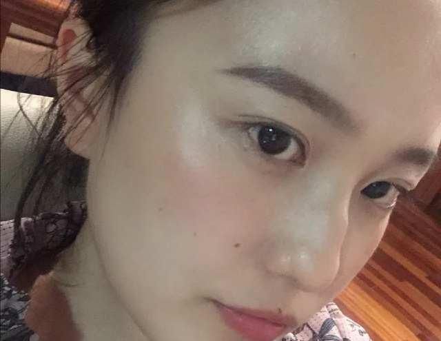  「样才能够」去闭口的八个小方法，简单有效，让你不再做“闭口”美人