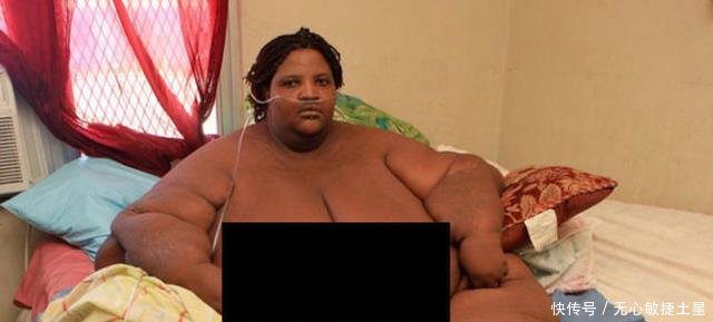 直击体重600斤的胖女人，胖到生活不能自理，16年都没有穿衣服