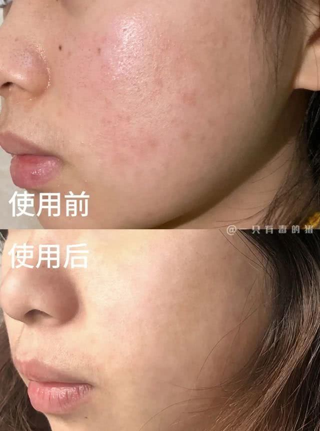  [科颜氏集焕]从几十试到上千块，终于找到有用的美白精华